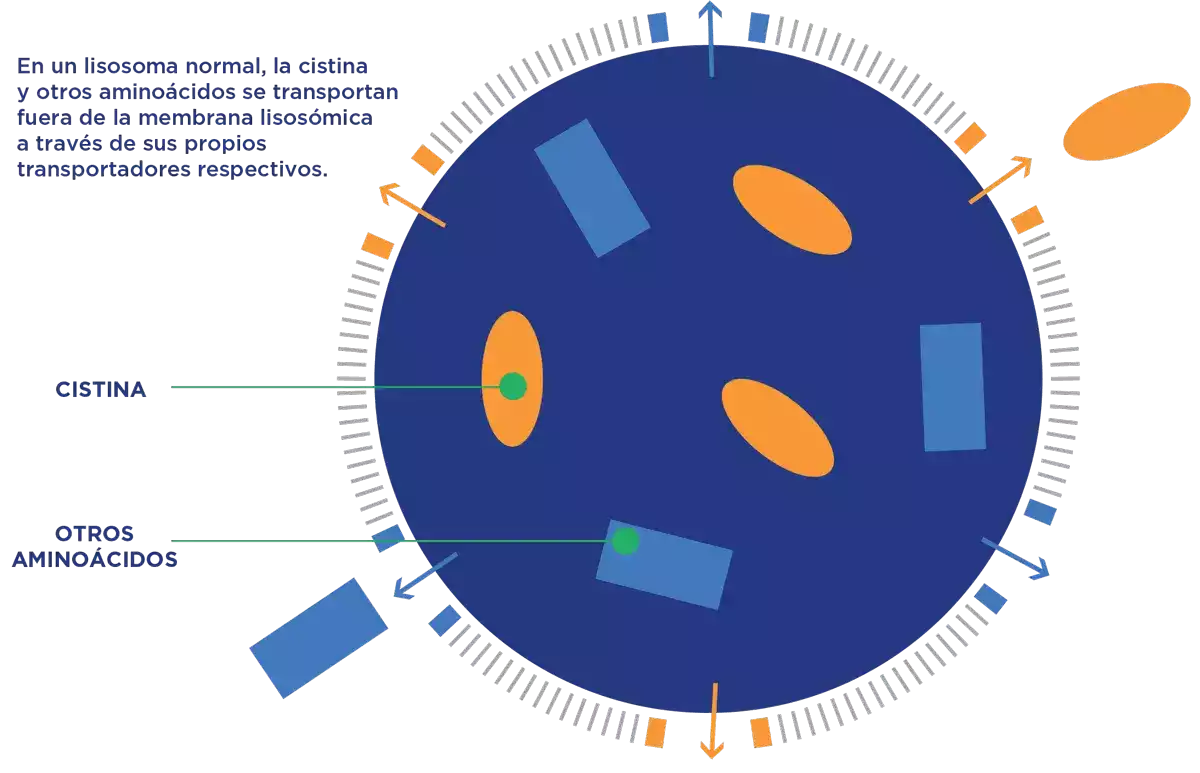 Cistinosis cuadro